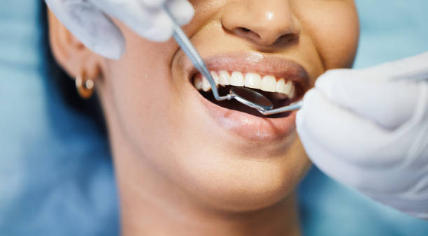 Best Emergency Root Canal Treatment in Glenwood, GA