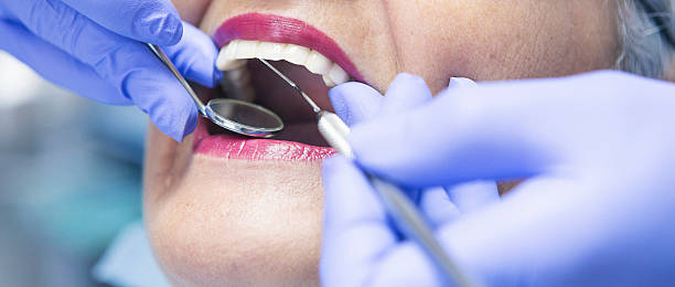Best Emergency Dentist for Lost Fillings or Crowns in Glenwood, GA