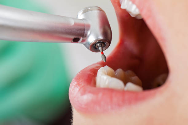 Best Emergency Dental Care for Abscessed Tooth in Glenwood, GA